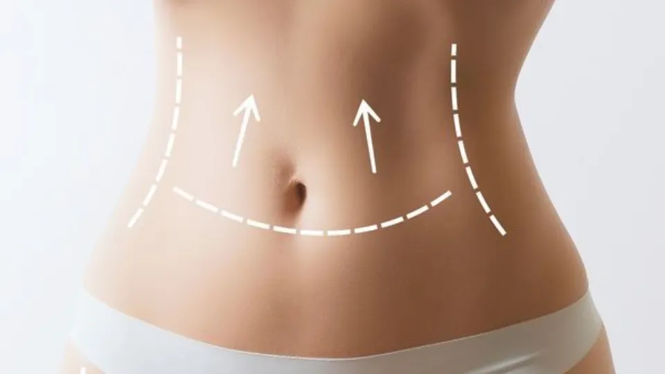 Пакет 10 антицелулитни масажа + подарък масаж лице София, кв. Изток