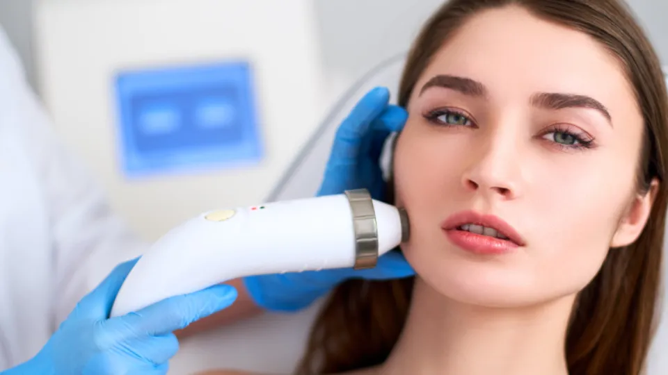 Радиочестотен лифтинг – лице, шия и деколте