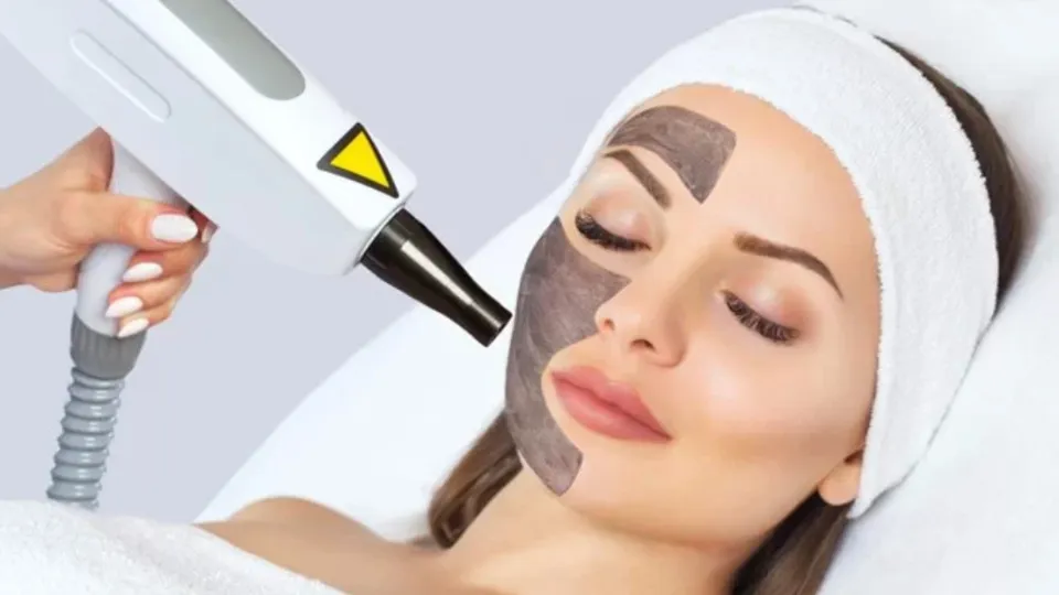 Карбонов пилинг за лице Фризьорство и козметика